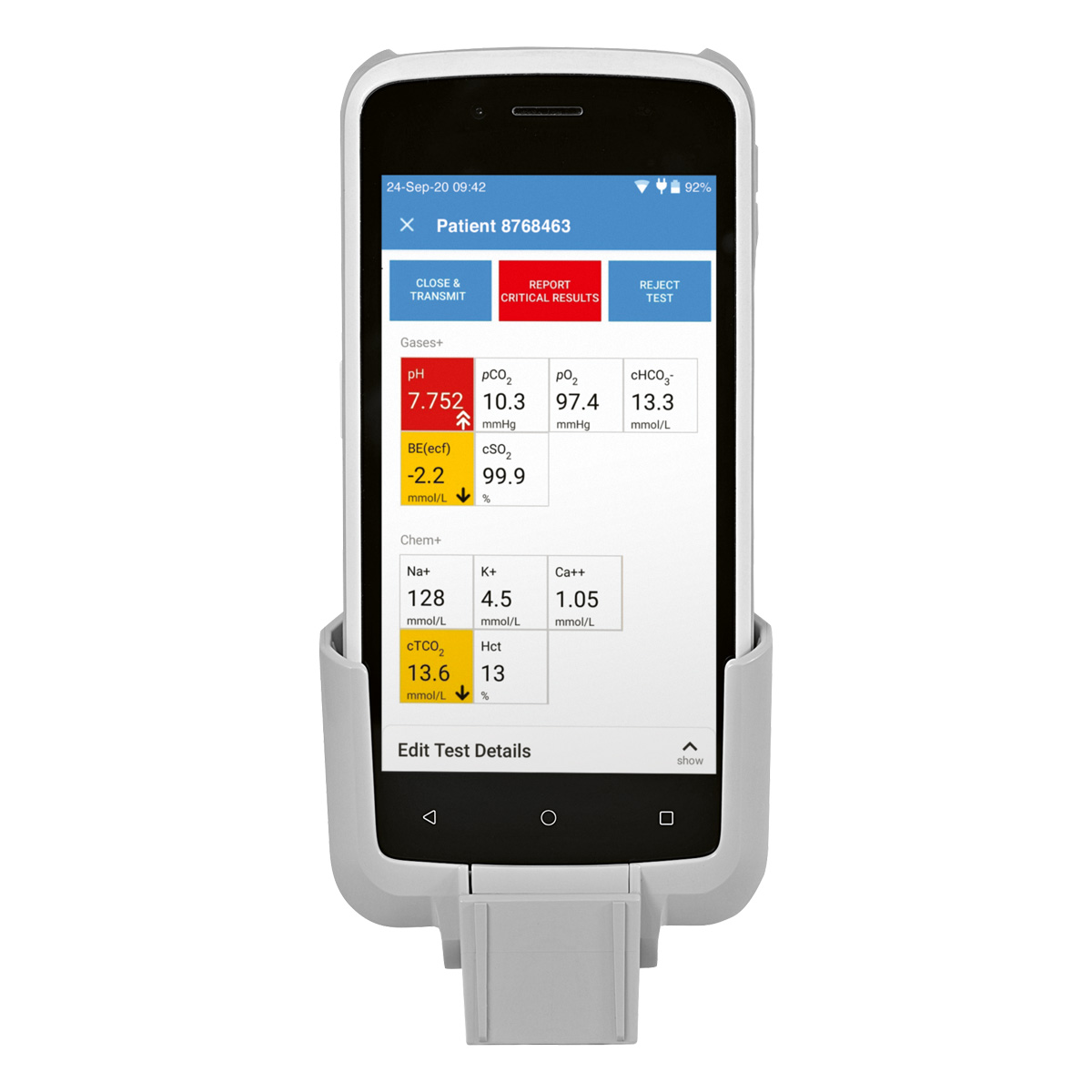 Handheld medical device displaying patient test results on a screen with multiple values highlighted.