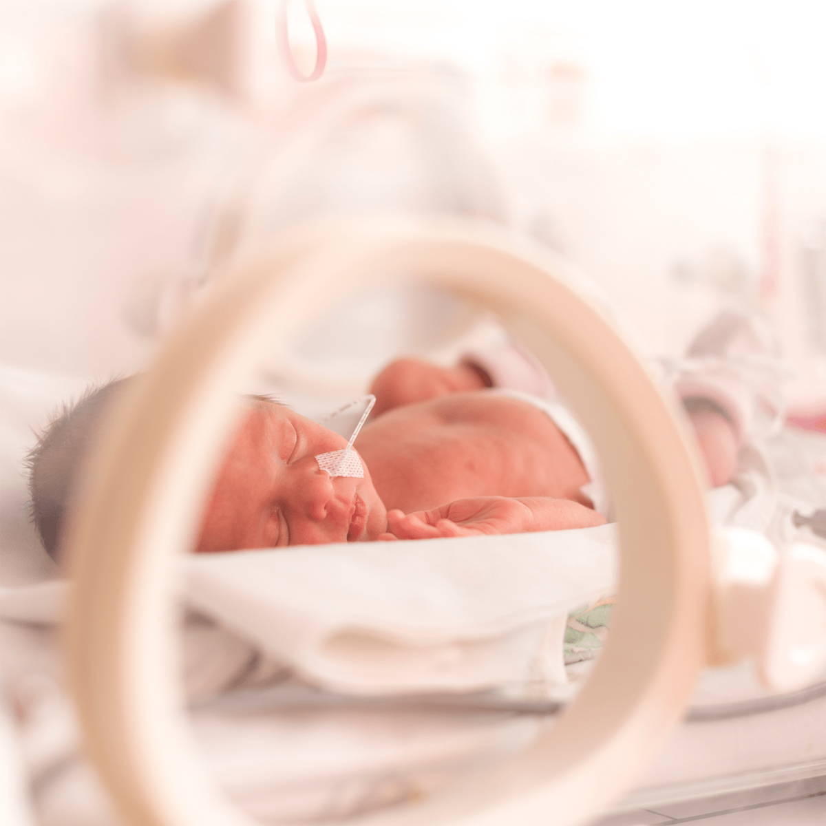 Newborn baby sleeping inside an incubator with a feeding tube attached to its nose in a hospital setting.