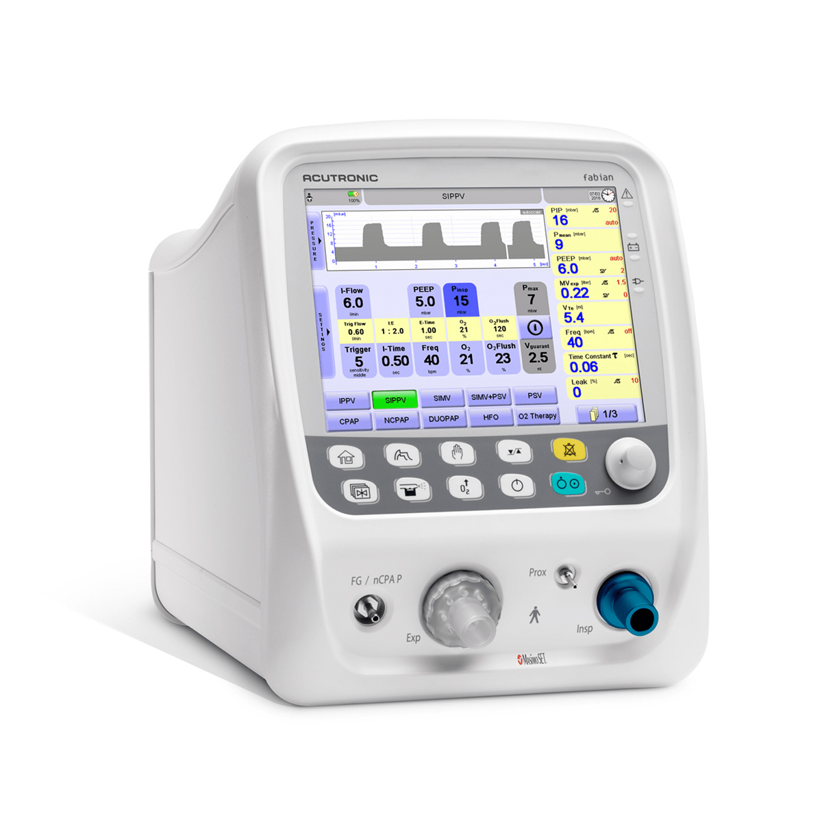 Medical ventilator with a digital display showing patient data, settings, and control buttons on the front panel.