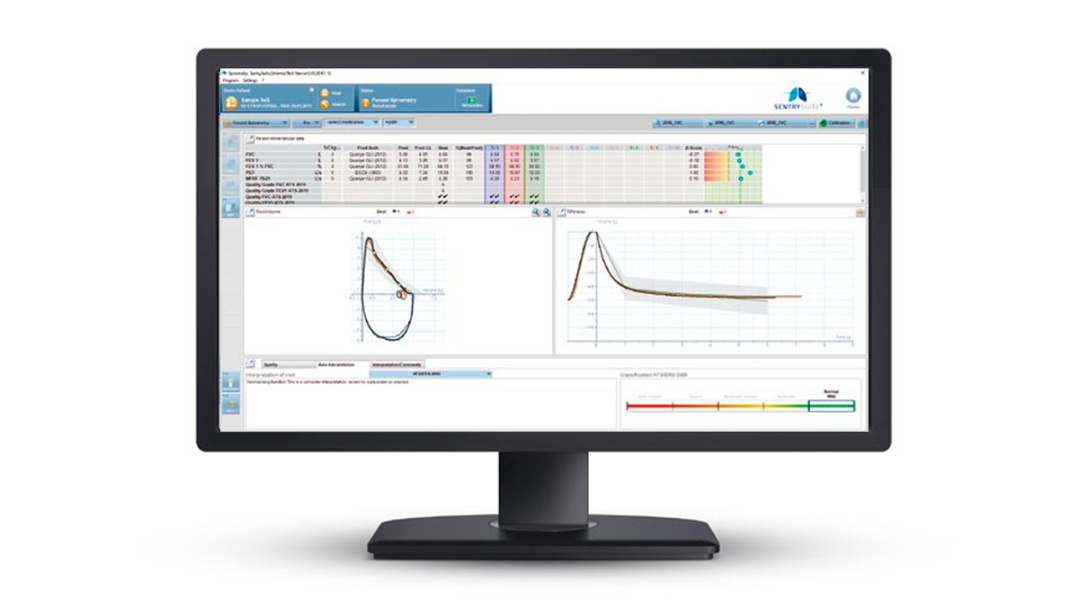 A computer monitor displays spirometry test results and lung function graphs with various data tables.