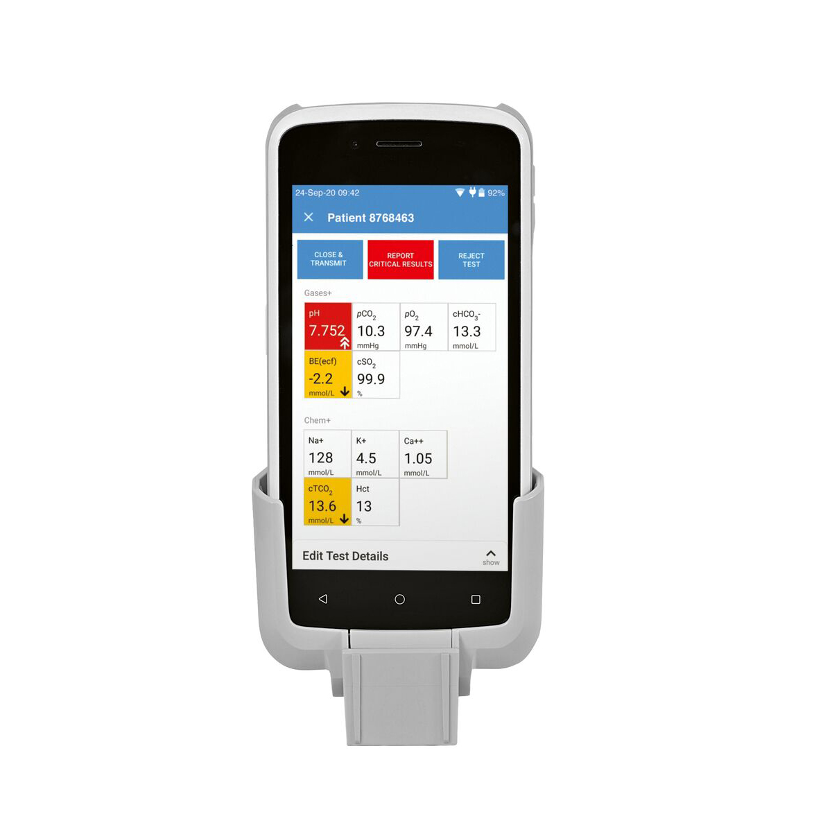 Handheld medical device displaying patient test results on a touchscreen, mounted in a white cradle.