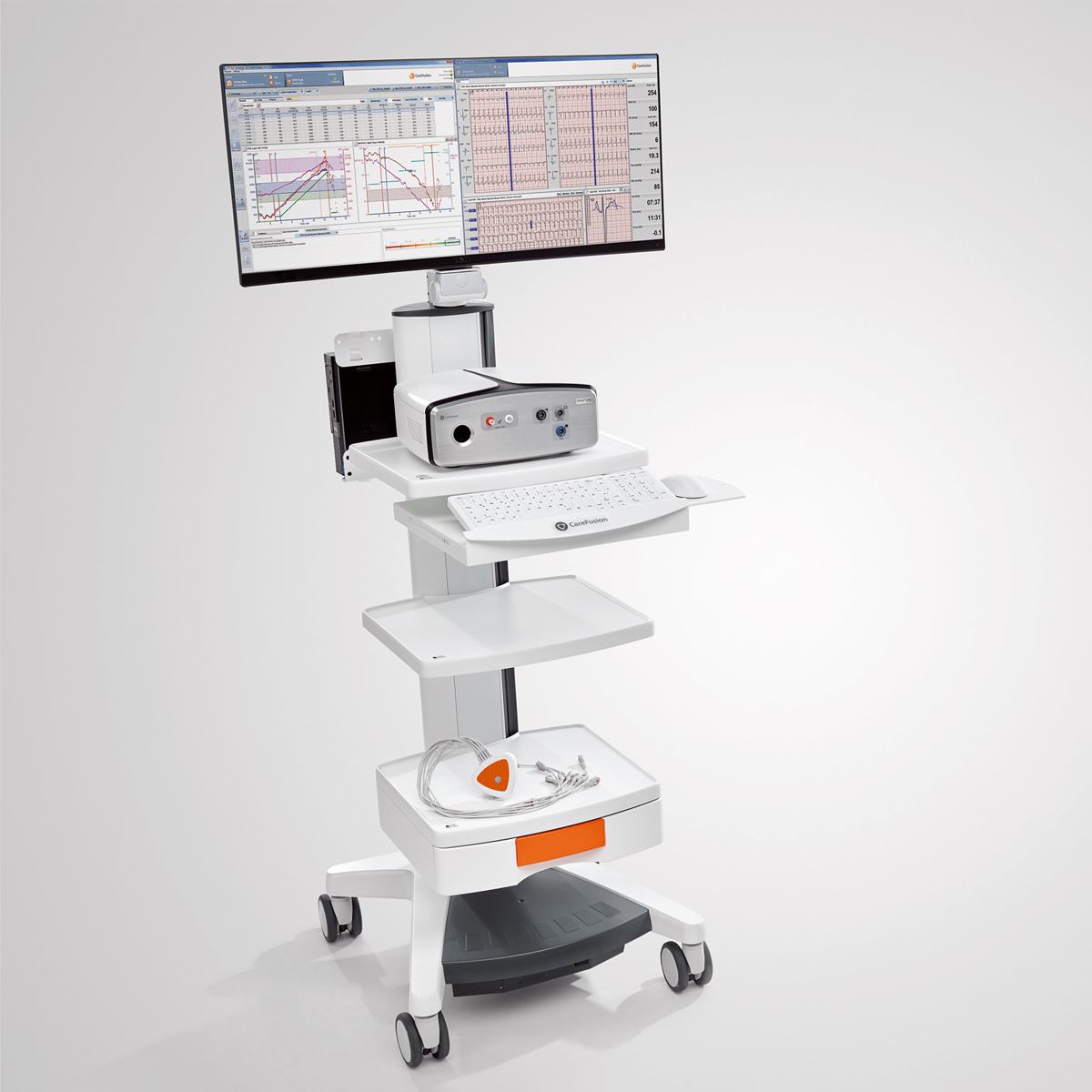 Medical diagnostic cart with a monitor displaying graphs, keyboard, equipment, and cables on shelves.