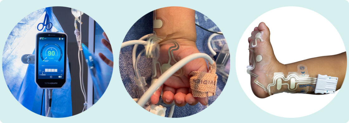 Three circular images show a medical monitor, a baby's hand with sensors, and a child's foot with electrodes.