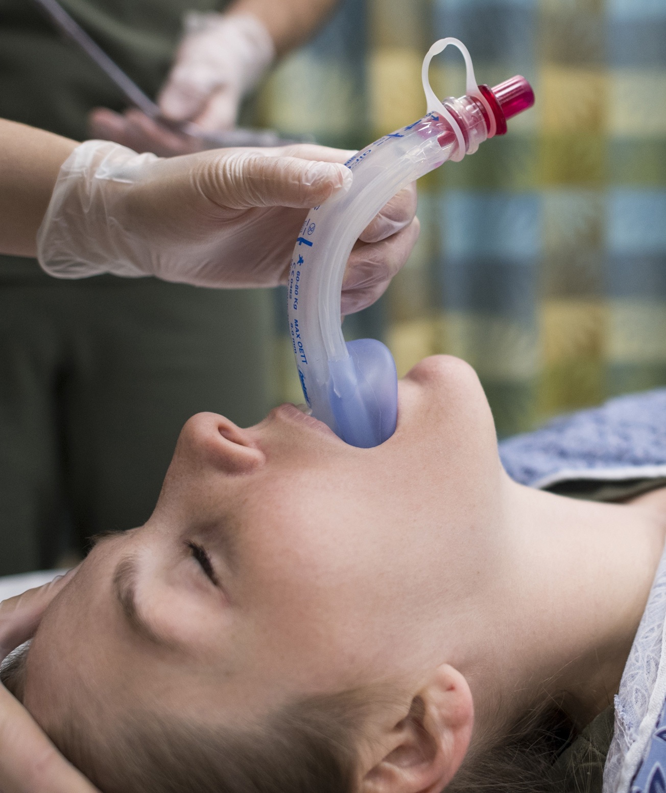 A person is having a medical airway device inserted into their mouth by a gloved healthcare worker.
